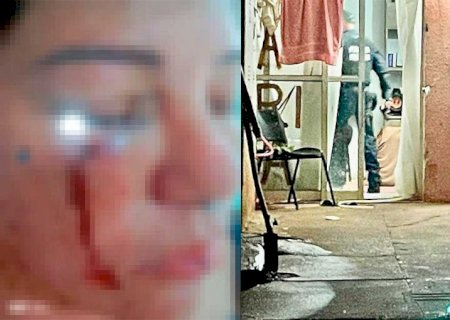 Mulher é brutalmente espancada um dia após se separar do ex-companheiro em Três Lagoas